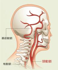 HP頭痛2.jpgのサムネイル画像